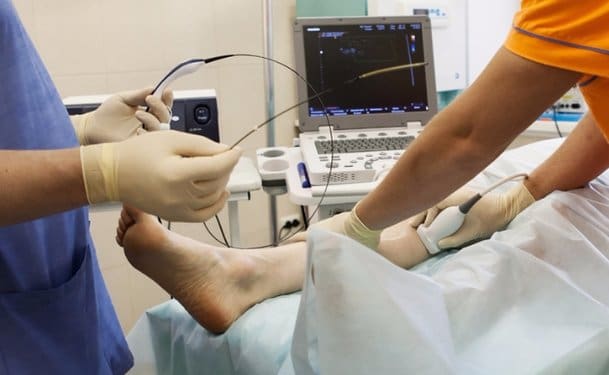 Radiofrequency ablation Radiofrequency ablation