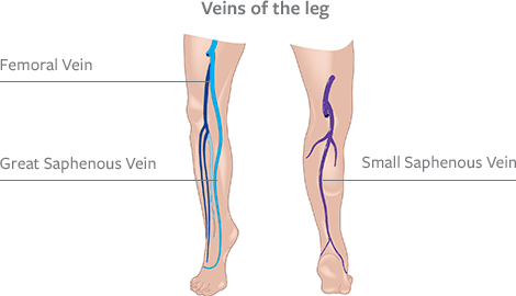 leg-vein-location-chart Leg Vein Location Chart