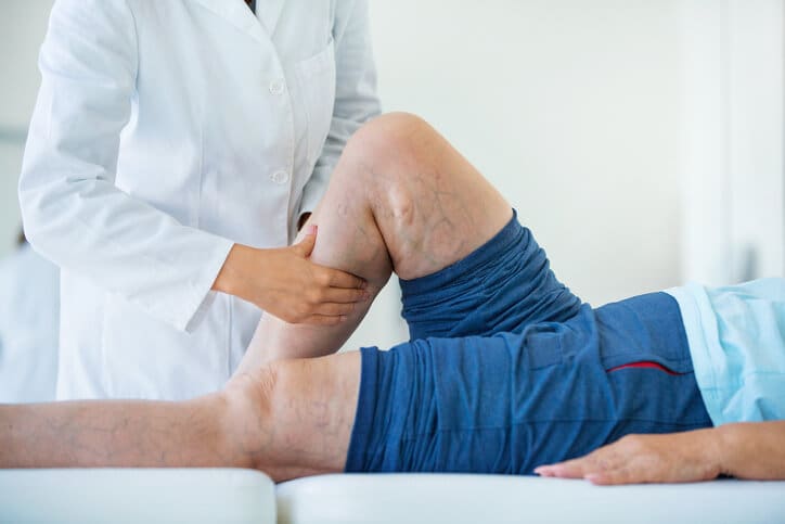 vein-treatment-canton-georgia Leg Vein Treatments in Canton, GA